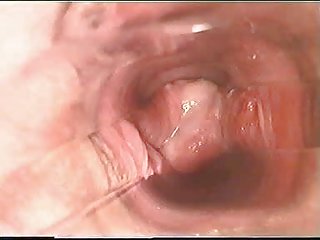 Porno vidio mamma un dēls iekšpusē maksts ar vīriešiem l7 dīvaini laiks